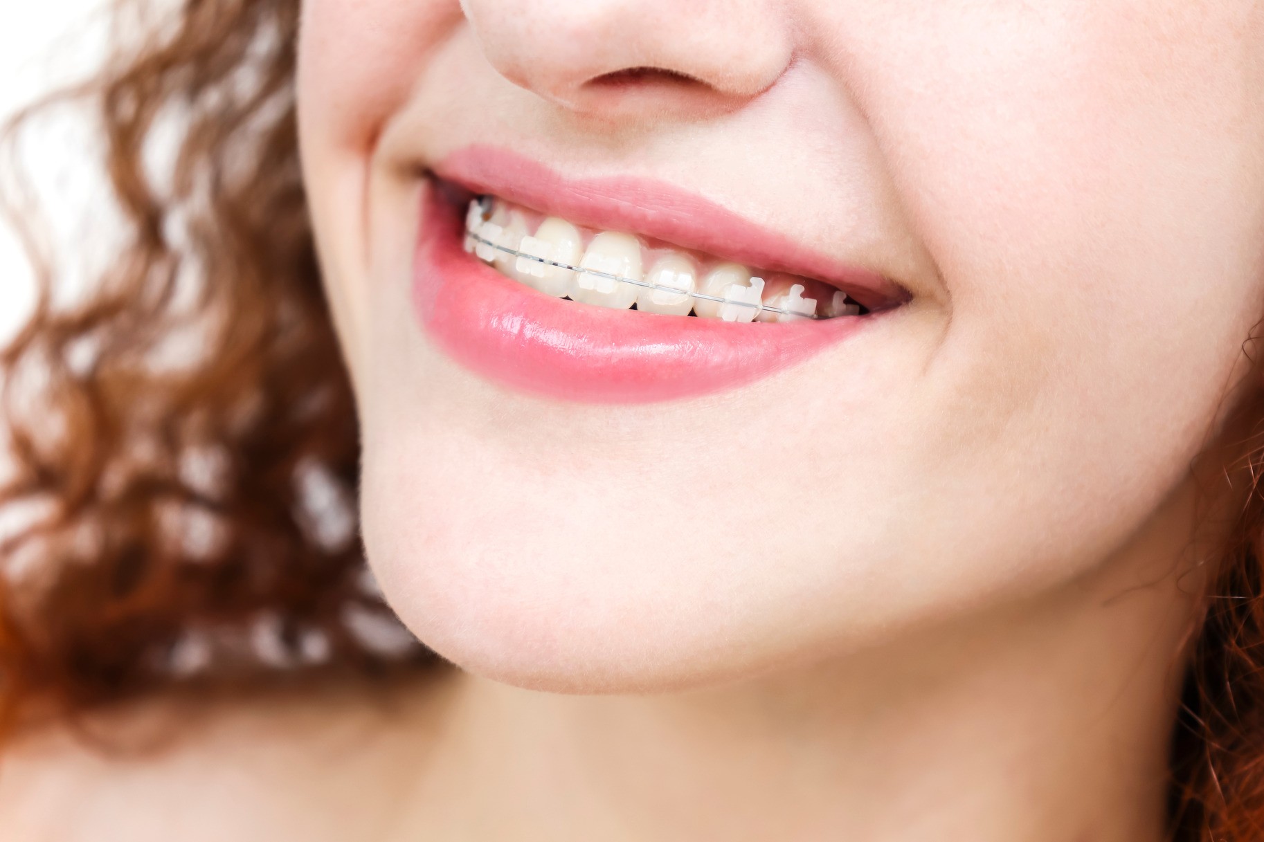 AdobeStock_210677325 v2 Woman showing off her clear braces after comrhensive treatment at REchtin Jacobs Orthodontics