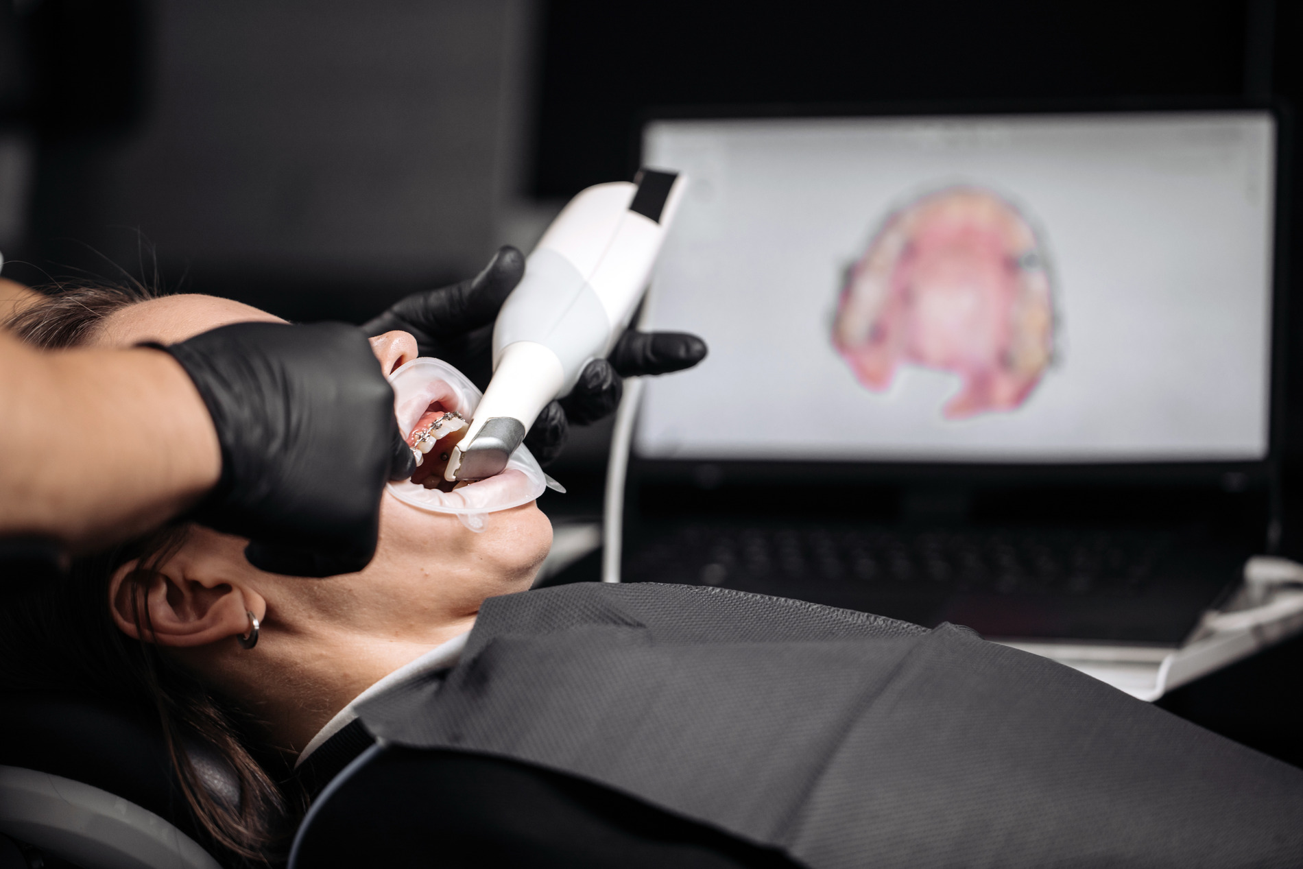 AdobeStock_1490354638 v2 Woman getting an orthodontic digital scan in Crestview Hills