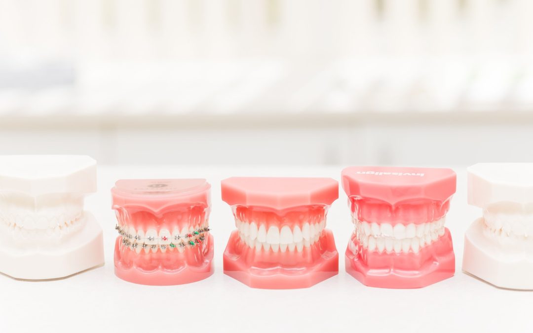How Do Orthodontists Straighten Teeth, Braces, Aligners, and More