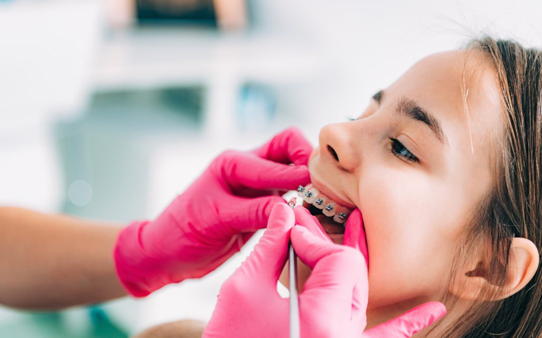 Early Orthodontic Intervention: What Parents Should Know About Phase 1 Treatment
