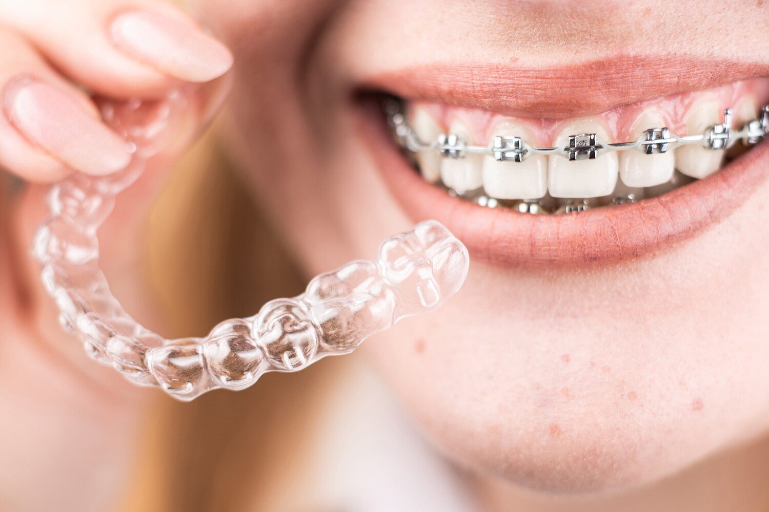 Girl with brace hold her invisalign at Rechtin Jacobs Orthodontics learning about the costs and benefits of treatment in Crestview Hills KY